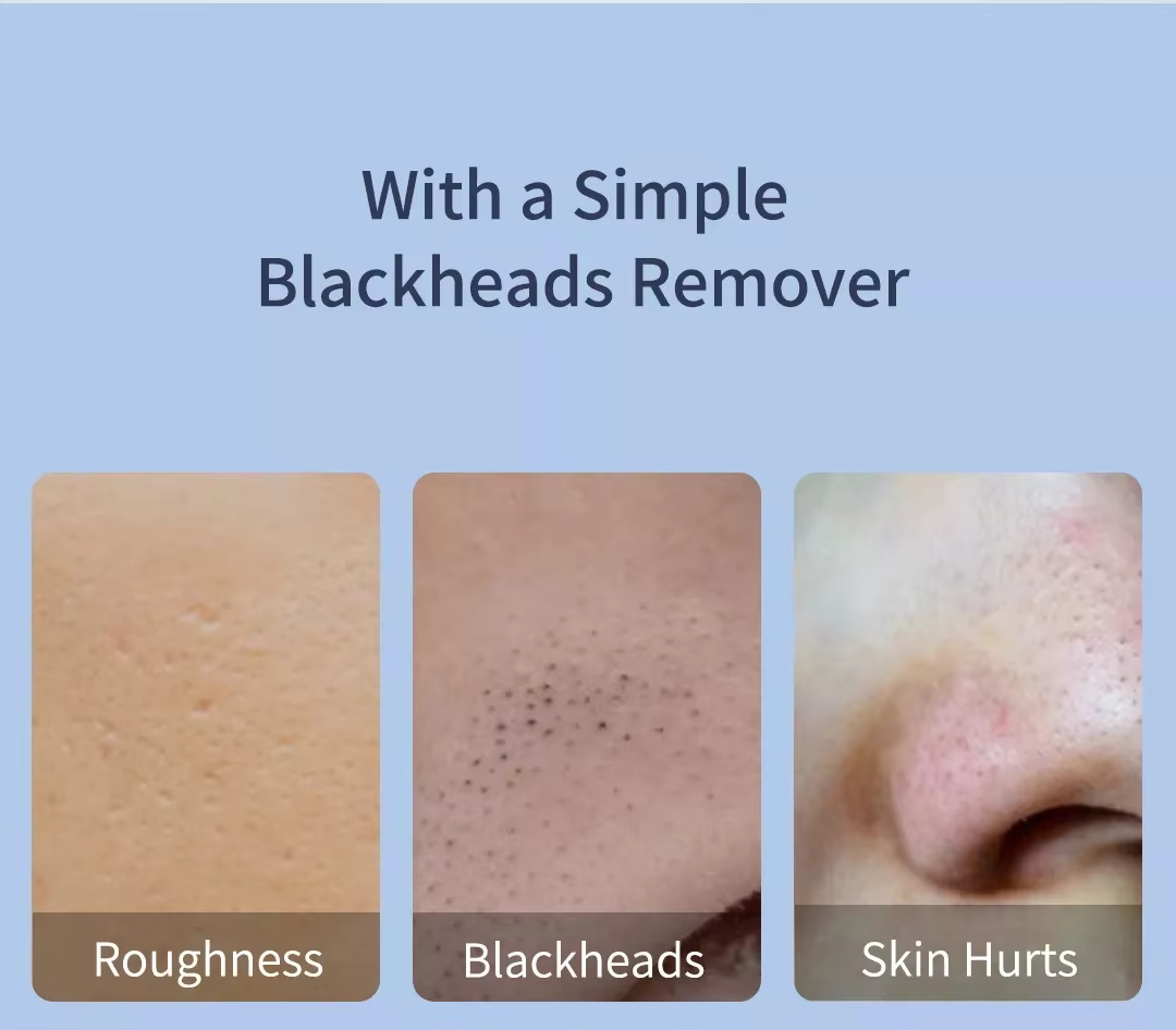 Xiaomi DOCO BH003 Ultra-Micro Bubble Blackhead Remover for home use